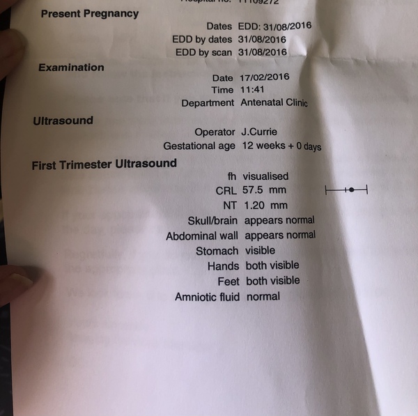 Scan photo - confusion
