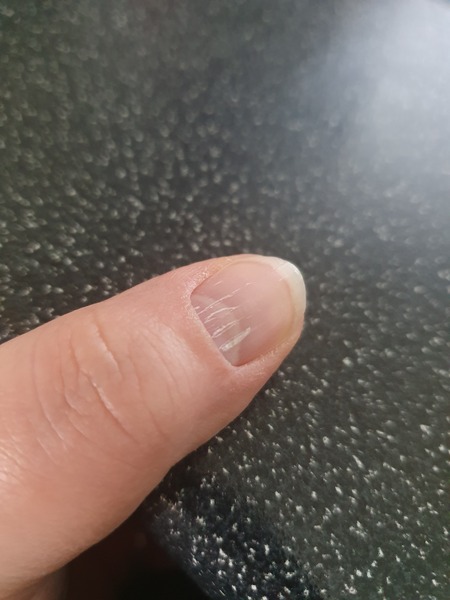 What's going on with my nails?
