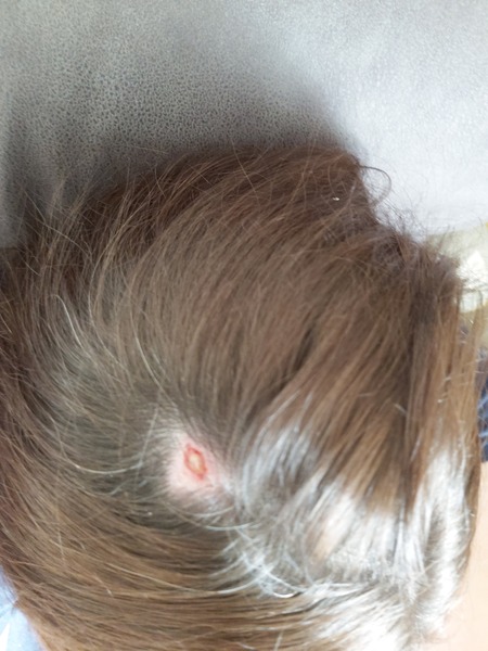 The best thing your body has produced *warning-grim content not suitable for weak-stomached persons*