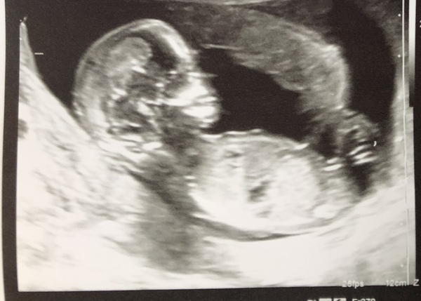 Sex guesses? 13+3 scan