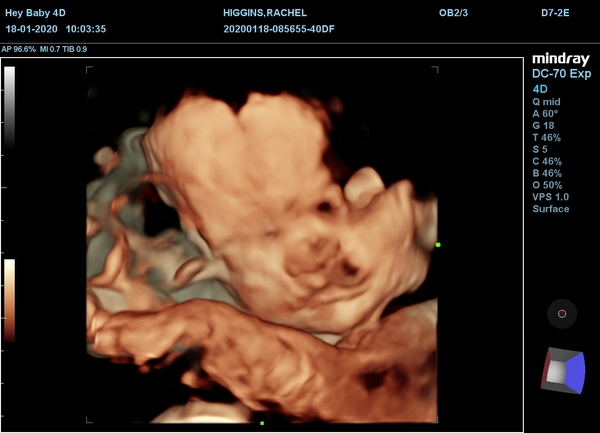 14 weeks - anyone else!?