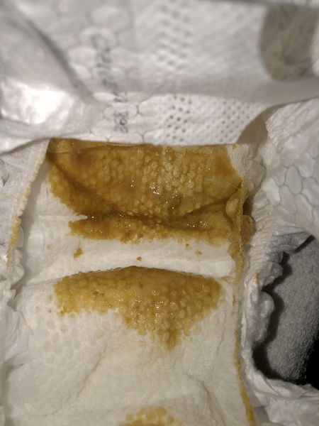 Reflux/allergy/colic/something else?