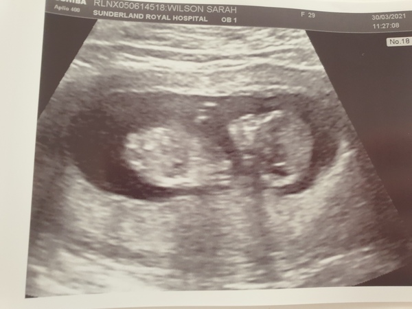 Gender guesses?