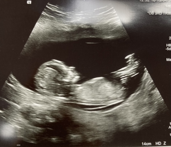 Do you want me to guess the sex? 12 week scans.