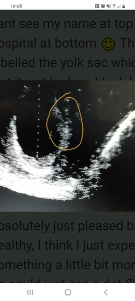 Scan photo - confusion