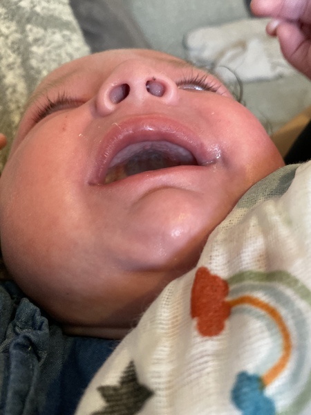 Does this look like teething?