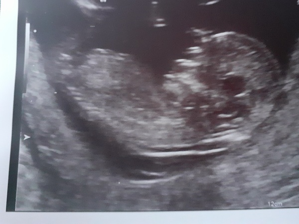 Boy or girl? 13w1d (I'm nearing my due date so will find out soon)