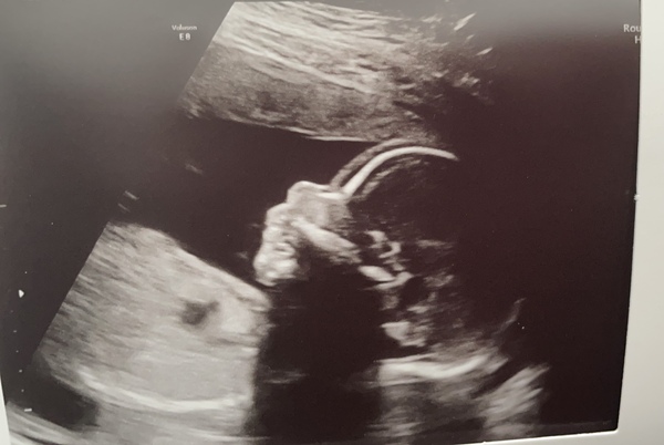 Aug 2021 - half way there!