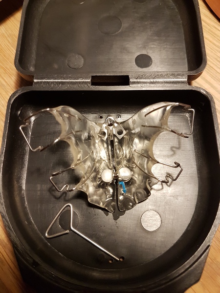 Anyone had the Inman Aligner...have I got the wrong thing? Photo