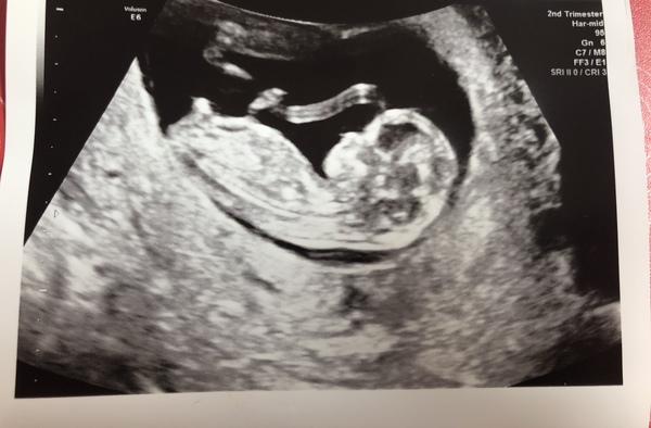 12 week sex guesses!