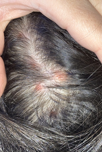 What is this skin condition? GP not helpful