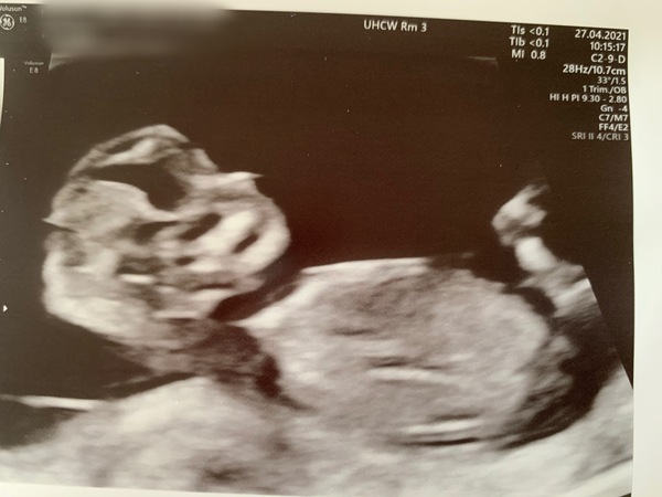 Boy or girl?