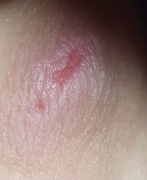 Rash experts - any idea