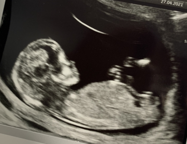 Due November 2021 - thread 2!