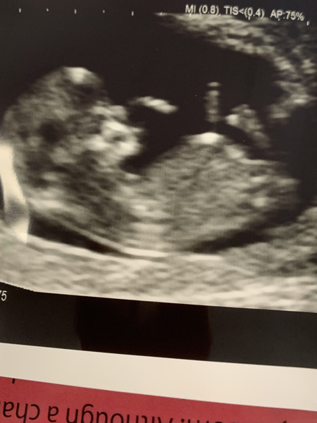 Due November 2021 - thread 2!