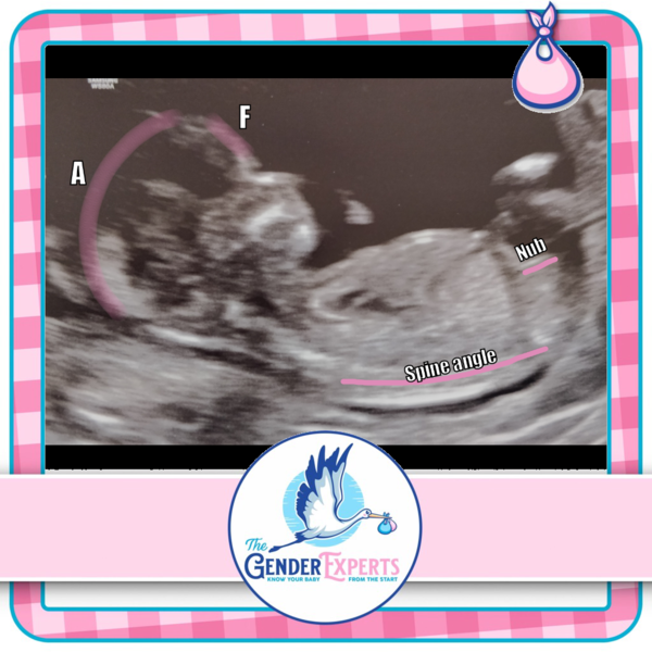 Gender Guesses 13+4