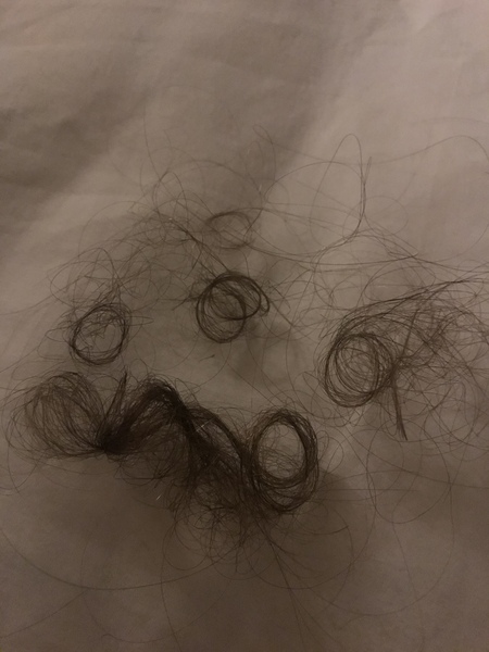 Is it normal to lose this much hair in one day?