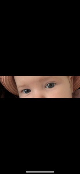 Toddler eyelid drooping/one eye bigger than the other. Should I be worried?