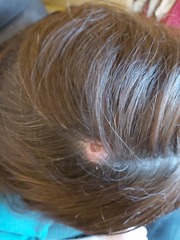 The best thing your body has produced *warning-grim content not suitable for weak-stomached persons*