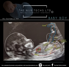 Gender Guesses 13+4