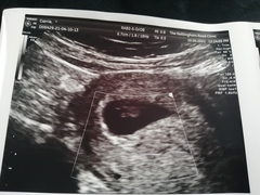 9 weeks since last period measuring 6mm crl no heartbeat