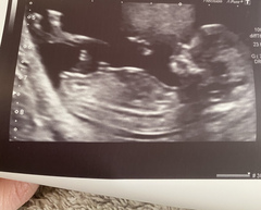 Do you want me to guess the sex? 12 week scans.