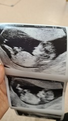 Gender guesses