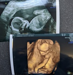 14 weeks - anyone else!?