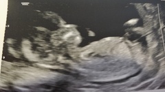Gender Guesses 13+4