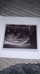 12 week scan