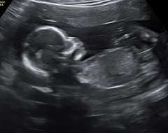 September 2021 - Thread 4