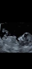 Gender guess pretty please x