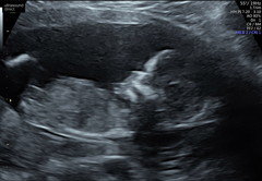 This is definitely a boy right?