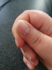 What's going on with my nails?