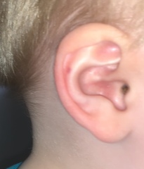 Toddler symptoms.. does this sound like meningitis?