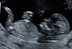 Gender guess pretty please x