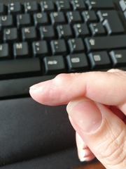 What is this on my finger