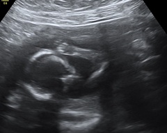 September 2021 - Thread 4