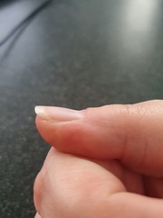 What's going on with my nails?