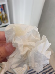 Help!!! Is this my mucus plug coming out? 32 weeks pregnant.picture attached!!!!