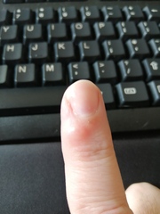 What is this on my finger