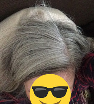 Should I embrace white hair at 47?