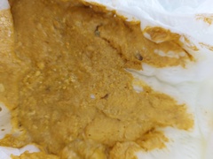 Dark brown/ black thread like bits in poo