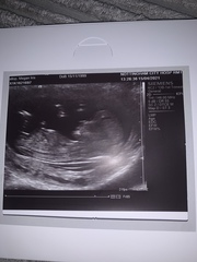 12 week scan