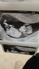 Gender guesses