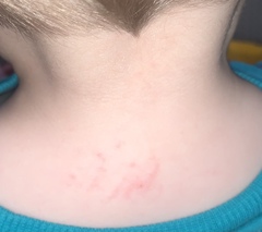 Toddler symptoms.. does this sound like meningitis?