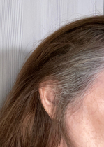 Hair Dilemma - need help (with pics)