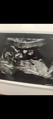 Do you want me to guess the sex? 12 week scans.