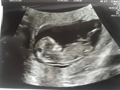 Tracking your cycle and possible BFP using RHR - part 5