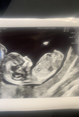 Another gender guess :)